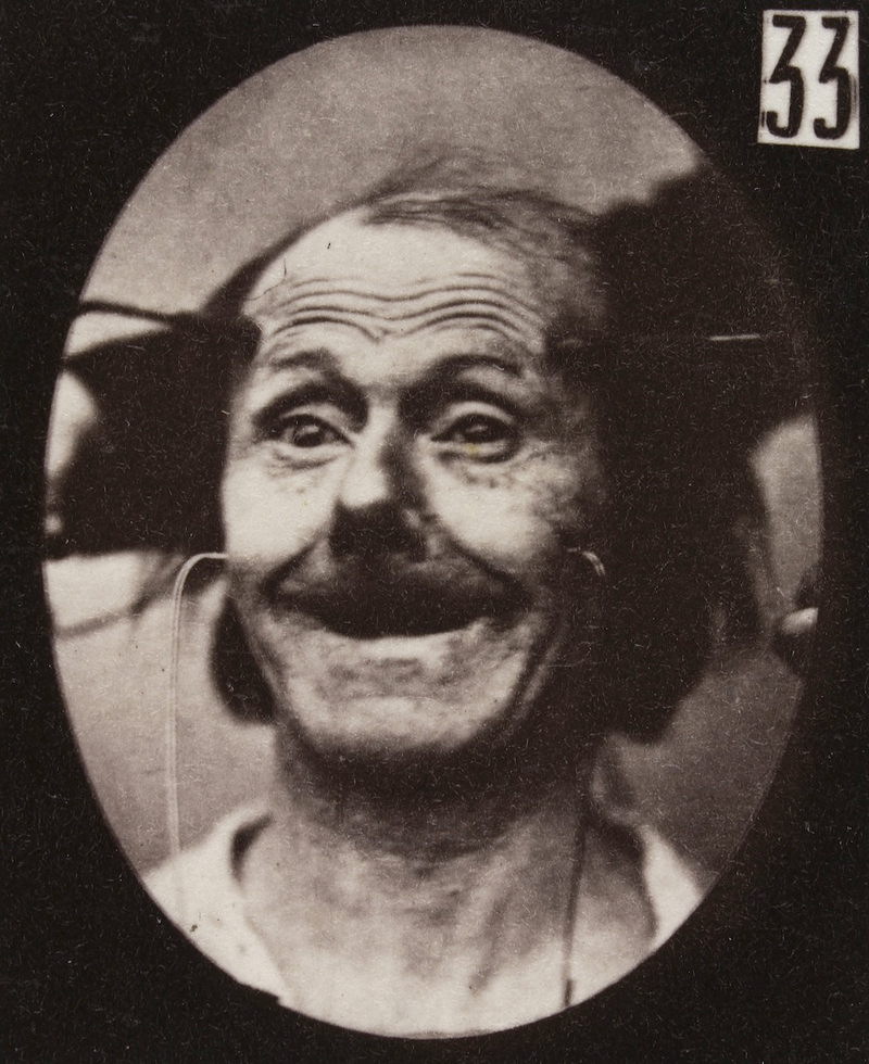 Illustration for article titled Terrifying, Century-Old Photographs from Neuroscience Experiments